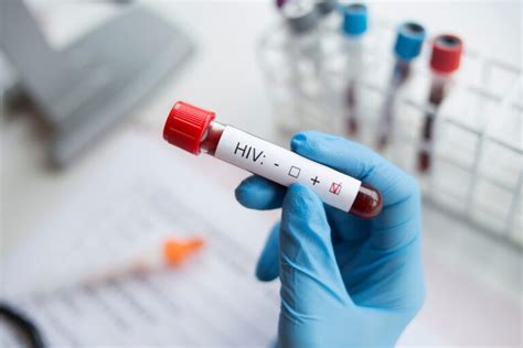 Sintomas Ng HIV Sa Maagang Yugto: Mga Dapat Malaman.